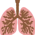 La Polmonite ab ingestis